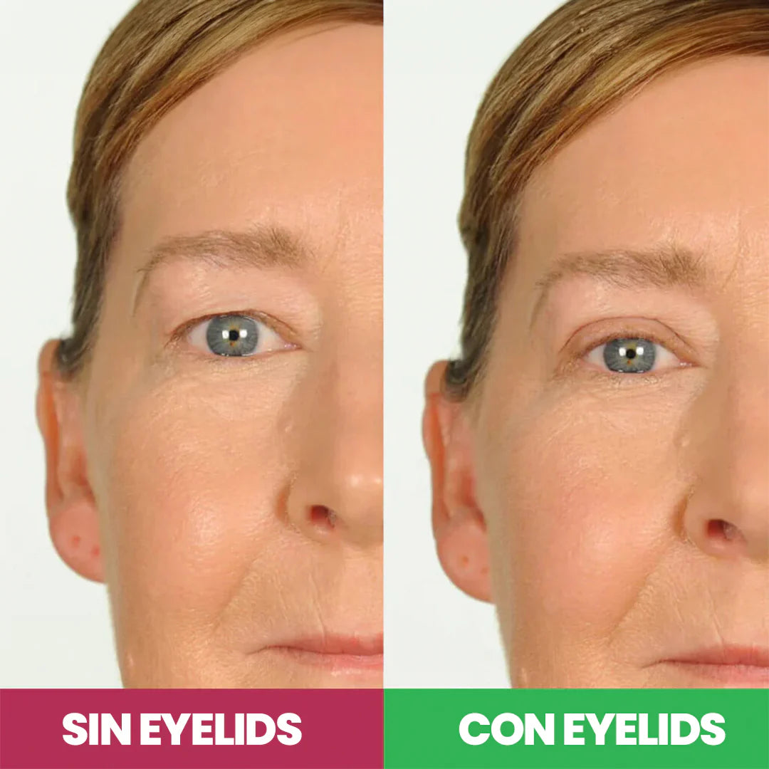 Bandas elevadoras de parpados - Eyelids® originales