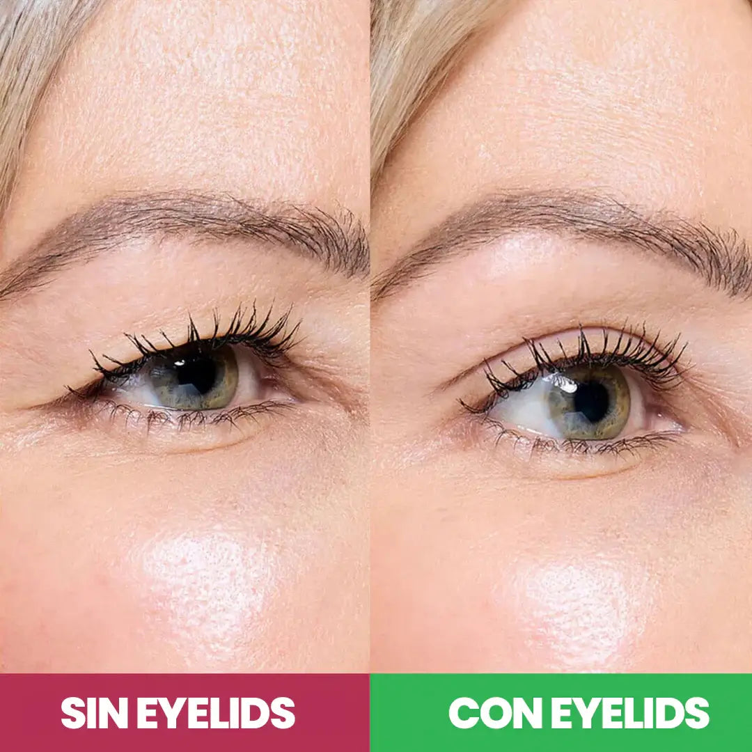 Bandas elevadoras de parpados - Eyelids® originales